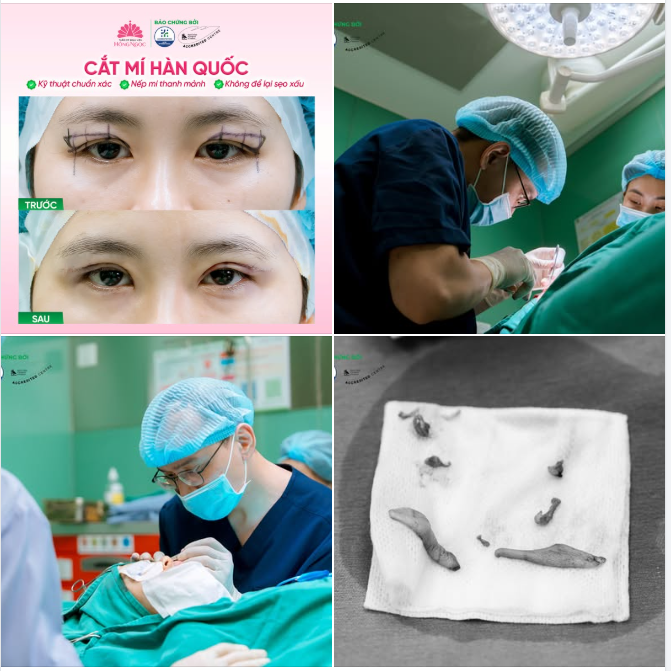 TINH CHỈNH NẾP MÍ - TÔN VINH THẦN THÁI RIÊNG