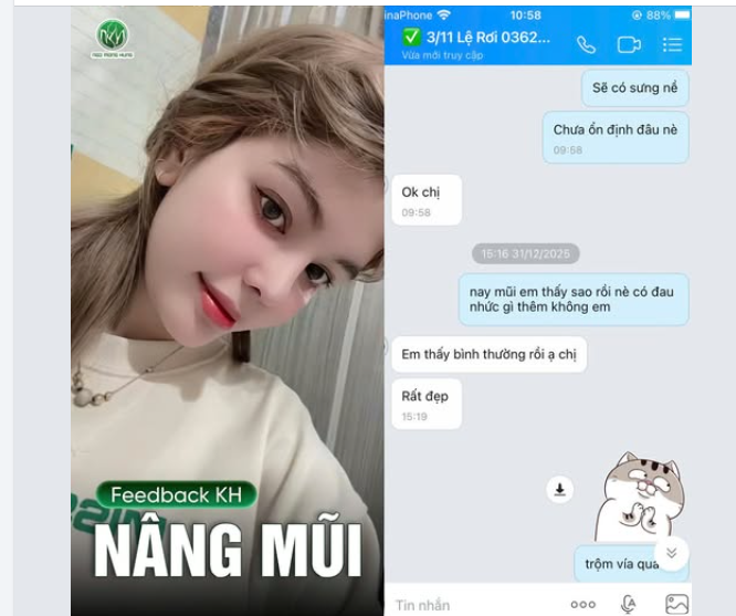 Vũ trụ gửi tín hiệu: Chiếc mũi cũ hết hạn sử dụng rồi, phải đi nâng mũi thôi!