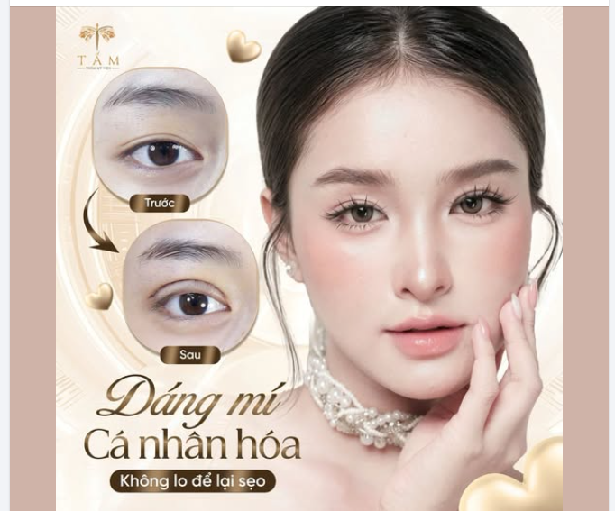 Dáng mí cá nhân hóa – Tự tin tỏa sáng với nét đẹp tự nhiên!