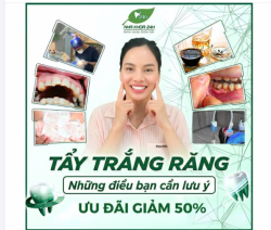 TẨY TRẮNG RĂNG – NHỮNG ĐIỀU BẠN CẦN LƯU Ý