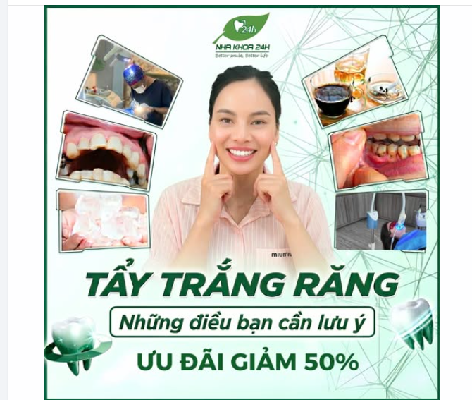 TẨY TRẮNG RĂNG – NHỮNG ĐIỀU BẠN CẦN LƯU Ý