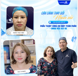 CẬN CẢNH THAY ĐỔI NHAN SẮC CỦA CHỊ VIỆT KIỀU MỸ
