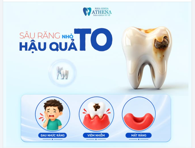 SÂU RĂNG NHỎ – HẬU QUẢ TO!