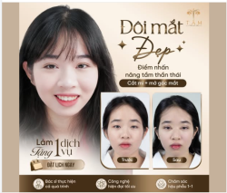 Trong thẩm mỹ mắt, tỷ lệ nếp mí, độ mở góc mắt và sự cân đối với gương mặt mới là yếu tố quyết định thần thái sau cùng