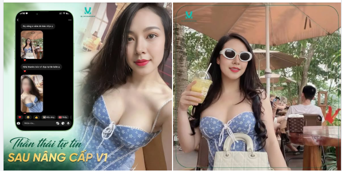 Khởi động ngày mới bằng feedback ngọt ngào từ khách yêu sau khi trải nghiệm dịch vụ nâng ngực tại Dr. Minh Phạm