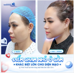 ĐIỂM CHẠM NHỎ Ở CẰM - KHÁC BIỆT LỚN CHO DIỆN MẠO