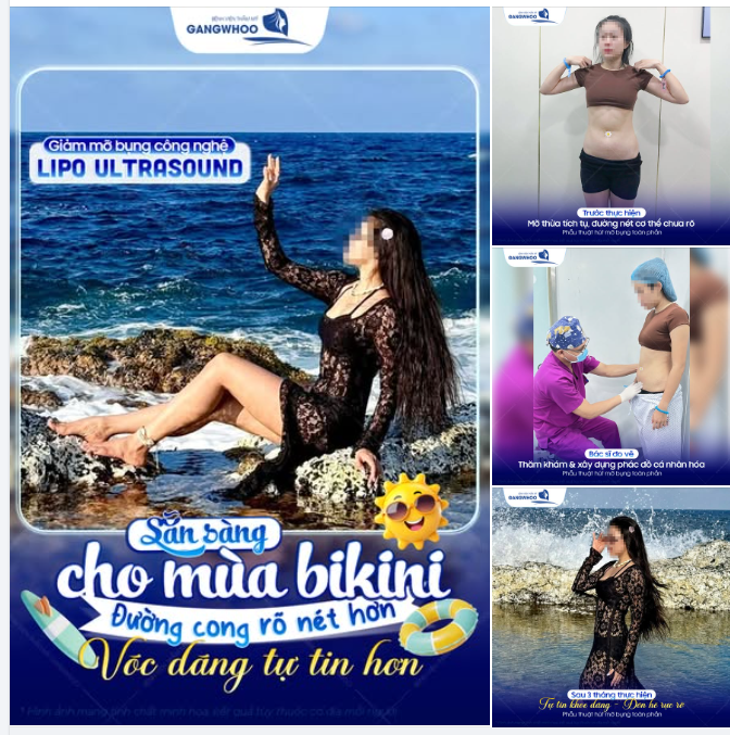 SẴN SÀNG CHO MÙA BIKINI – VÓC DÁNG TỰ TIN, ĐÓN HÈ RỰC RỠ