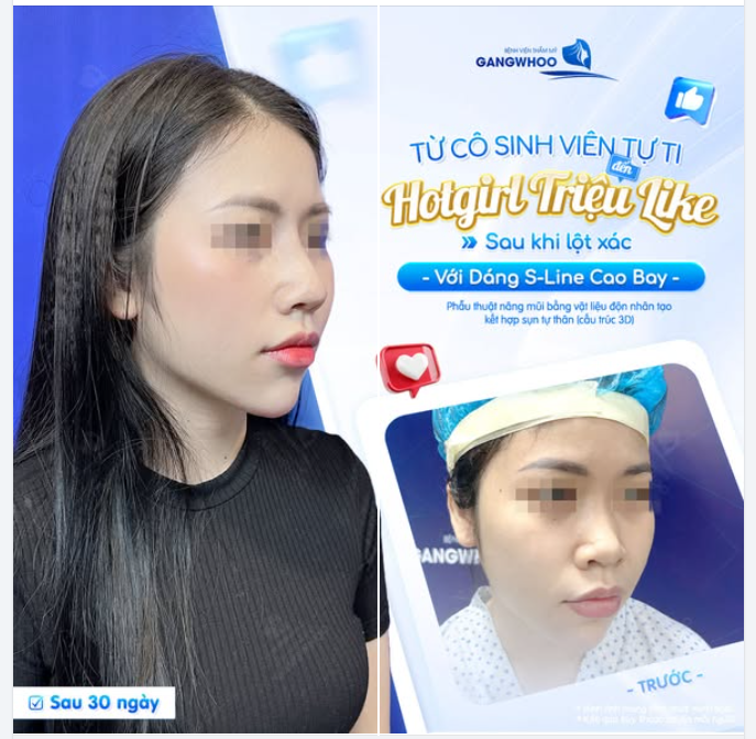 TỪ CÔ SINH VIÊN TỰ TI ĐẾN HOTGIRL TRIỆU LIKE
