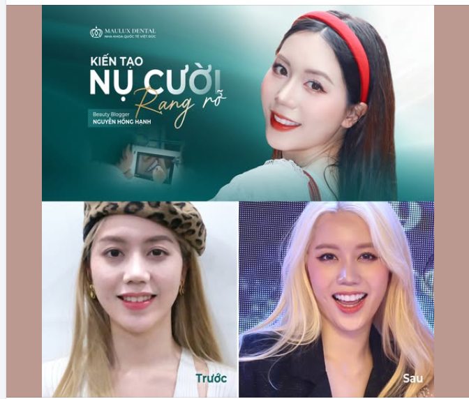 KIẾN TẠO NỤ CƯỜI RẠNG RỠ