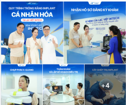 U30 NIỀNG RĂNG XONG LẤY CHỒNG LUÔN