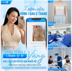 ZOOM CẬN VÒNG 1 SAU 3 THÁNG - DÁNG VÒNG 1 CHUẨN TỶ LỆ VÀNG, KHE LINEX QUYẾN RŨ VẠN NGƯỜI MÊ