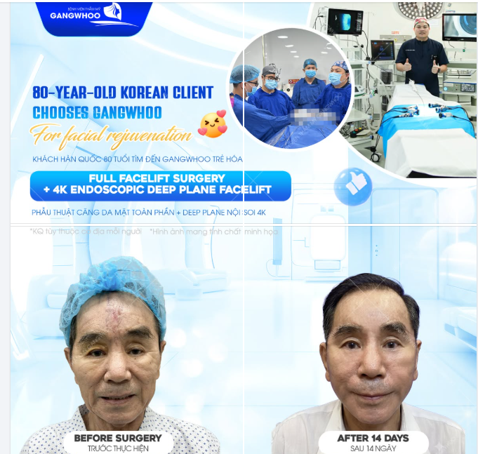 KHÁCH HÀN QUỐC 80 TUỔI TÌM ĐẾN GANGWHOO TRẺ HÓA