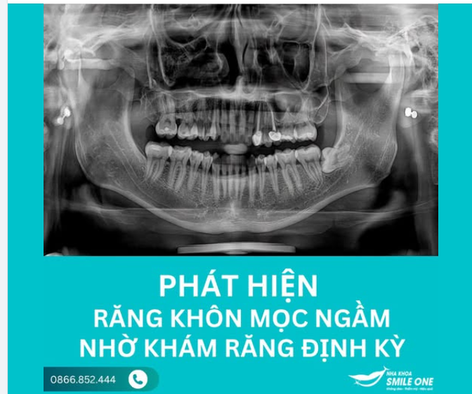 KHÔNG PHẢI TẤT CẢ CÁC VẤN ĐỀ RĂNG MIỆNG ĐỀU GÂY ĐAU.