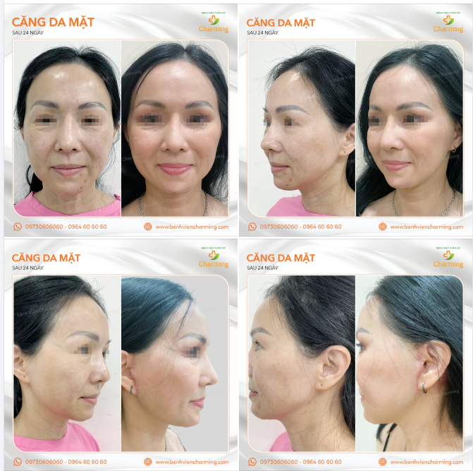 CĂNG DA MẶT - GÌN GIỮ NÉT THANH XUÂN