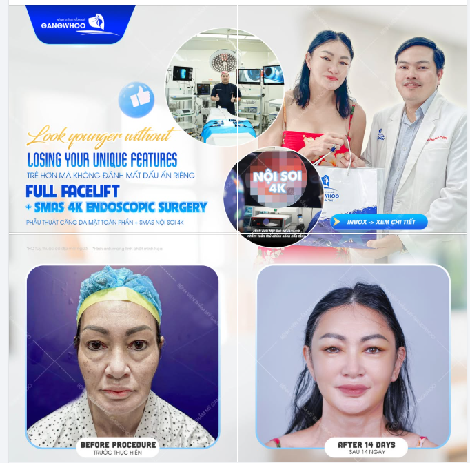 TRẺ HÓA MÀ KHÔNG ĐÁNH MẤT DẤU ẤN RIÊNG