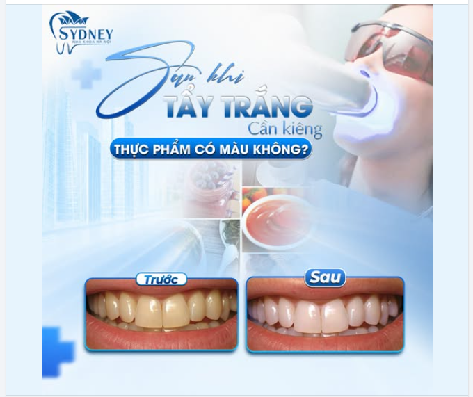 TẠI SAO SAU TẨY TRẮNG BẠN CẦN KIÊNG THỰC PHẨM CÓ MÀU?