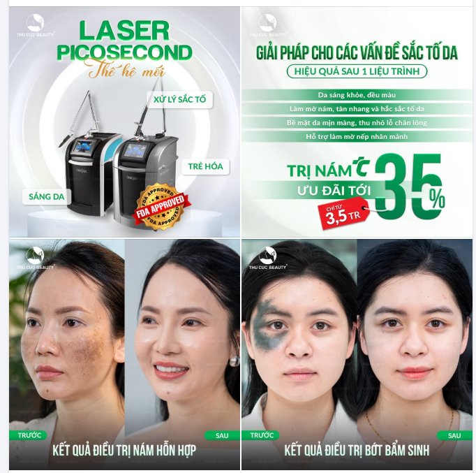 Laser Picosecond tại Thu Cúc: Xử lý hiệu quả sắc tố cứng đầu, trả lại da mộc sáng khỏe