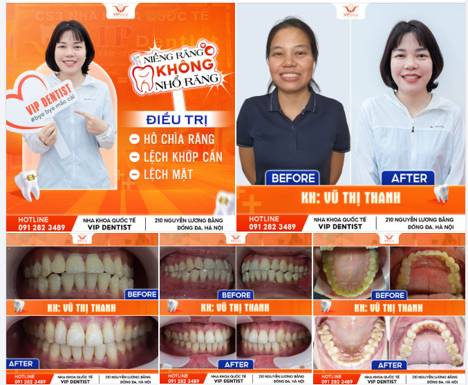 TRẺ TRUNG HƠN - RẠNG RỠ HƠN KHI THÁO NIỀNG Ở TUỔI U40!