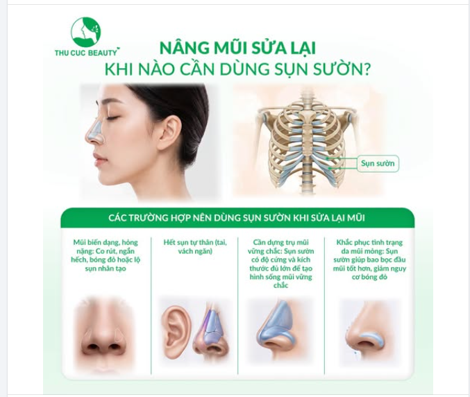 NÂNG MŨI SỬA LẠI KHI NÀO CẦN DÙNG SỤN SƯỜN?