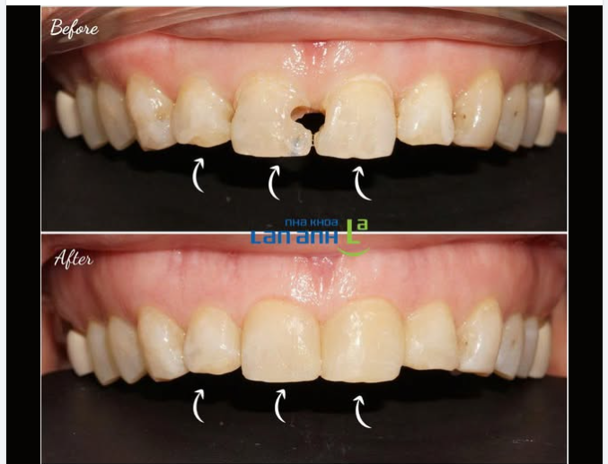 Đôi khi, chỉ vậy thôi cũng đủ để nụ cười trở nên hài hòa hơn.