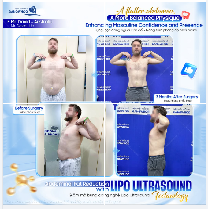 Trong những năm gần đây, anh David (Úc) chia sẻ rằng mình bắt đầu quan tâm nhiều hơn đến sức khỏe, ngoại hình và sự tự tin trong công việc cũng như cuộc sống thường ngày.