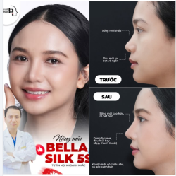 45 PHÚT NÂNG MŨI VÀ CÔNG NGHỆ 3D THAY ĐỔI ĐỊNH KIẾN "HÊN XUI" KHI ĐI LÀM ĐẸP!