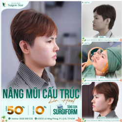 NÂNG MŨI CẤU TRÚC DR. HOẠT - 60 PHÚT LÀM NÊN SỰ KHÁC BIỆT
