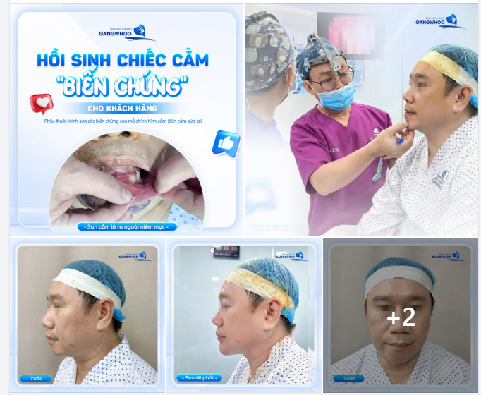 HỒI SINH CHIẾC CẰM BIẾN CHỨNG CHO KHÁCH HÀNG