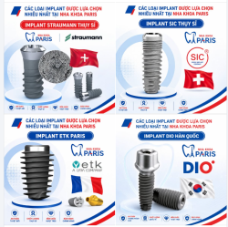 TOP 04 TRỤ IMPLANT ĐƯỢC LỰA CHỌN NHIỀU NHẤT TẠI NHA KHOA PARIS
