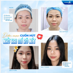 HAI MÍ RÕ NÉT - DIỆN MẠO CUỐN HÚT