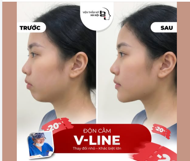 GIẢI MÃ "TỶ LỆ 1/3" – BÍ MẬT CỦA MỘT GƯƠNG MẶT THU HÚT ÁNH NHÌN!