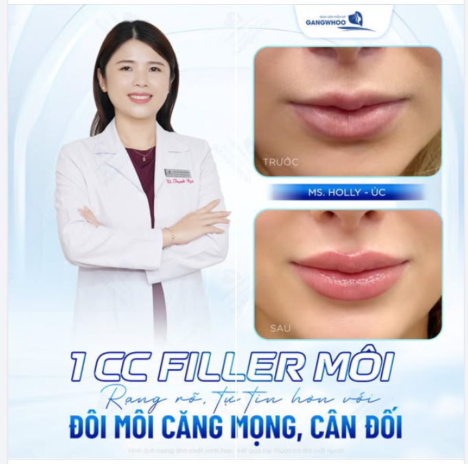 RẠNG RỠ HƠN VỚI ĐÔI MÔI CĂNG MỌNG