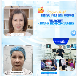 KHÔNG CHỈ CĂNG DA MÀ CÒN LÀM MỚI CẢ THẦN THÁI