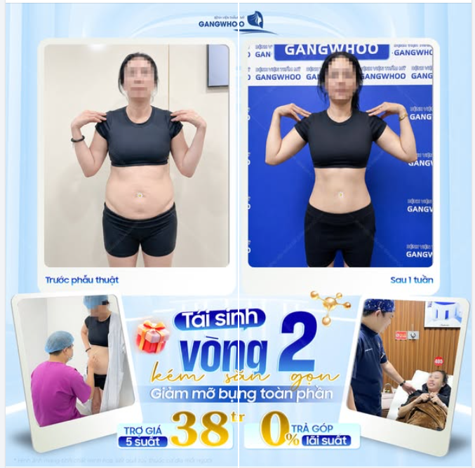 KIẾN TẠO VÒNG EO THON GỌN VÀ SĂN CHẮC
