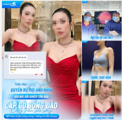THẦN THÁI NGÚT NGÀN, QUYẾN RŨ MỌI ÁNH NHÌN - KHI NÚI ĐÔI KHIÊM TỐN HOÁ CẶP GÒ BỒNG ĐẢO CĂNG TRÀN SỨC SỐNG