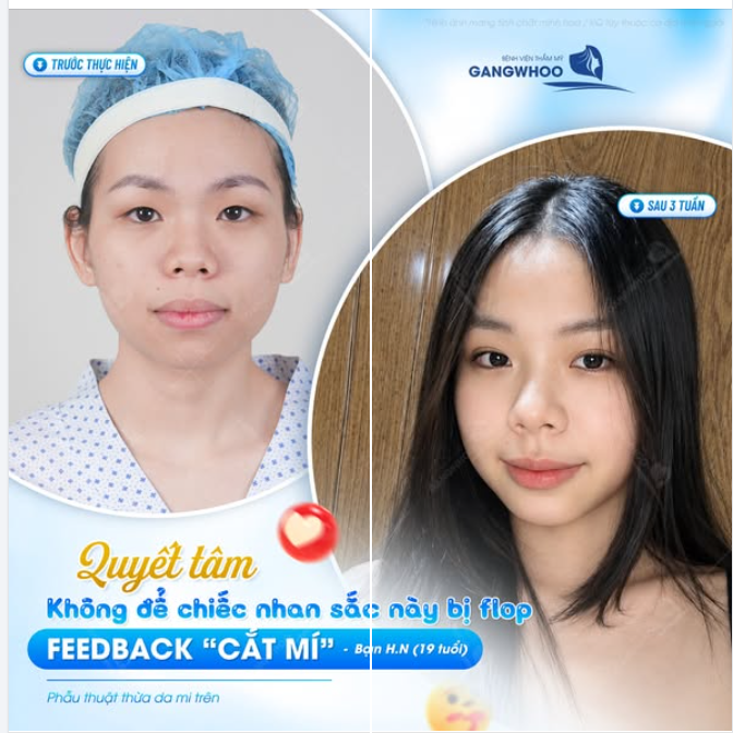 QUYẾT TÂM KHÔNG ĐỂ CHIẾC NHAN SẮC NÀY BỊ FLOP