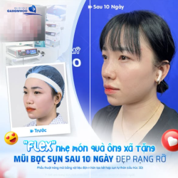 "FLEX" NHẸ MÓN QUÀ ÔNG XÃ TẶNG