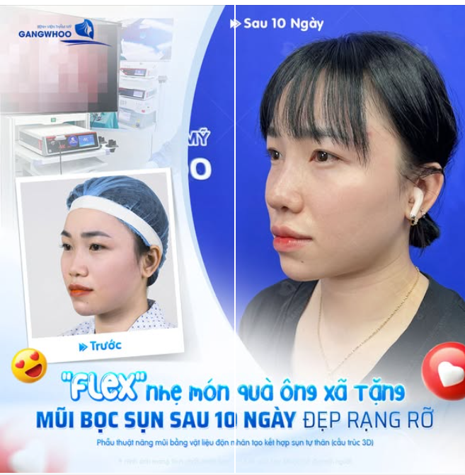 "FLEX" NHẸ MÓN QUÀ ÔNG XÃ TẶNG