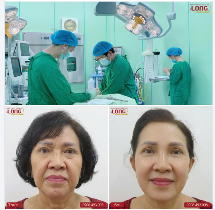 Tại sao ngày càng có nhiều khách hàng tìm đến PTTM Bác sĩ Long căng da mặt ?