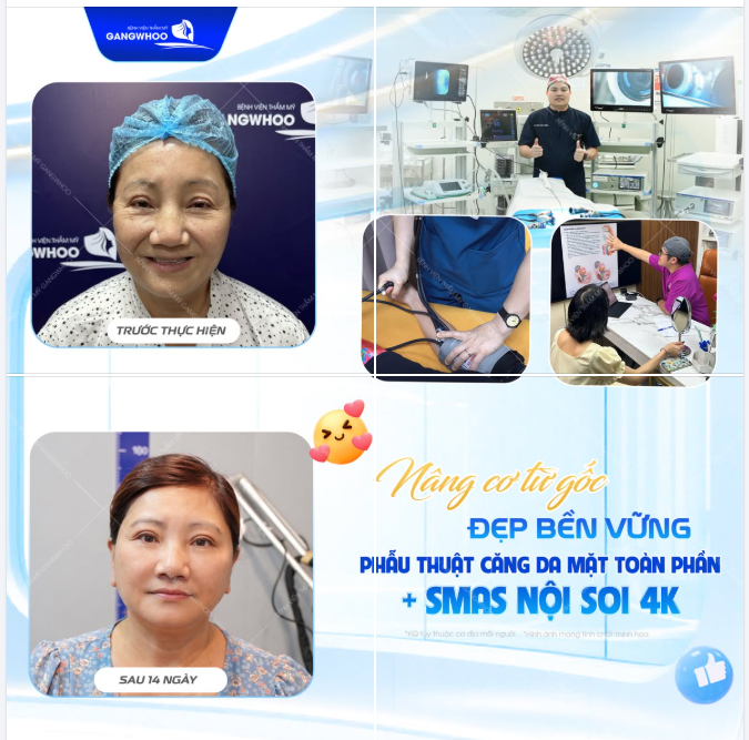 NÂNG CƠ TỪ GỐC - ĐẸP BỀN VỮNG SAU 1 LẦN THỰC HIỆN