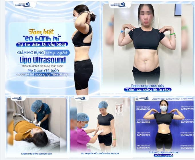 TỰ TIN DIỆN LẠI VÁY BODY