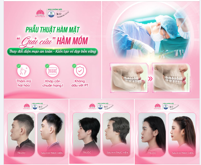 PHẪU THUẬT HÀM MẶT - "GIẢI CỨU" HÀM MÓM