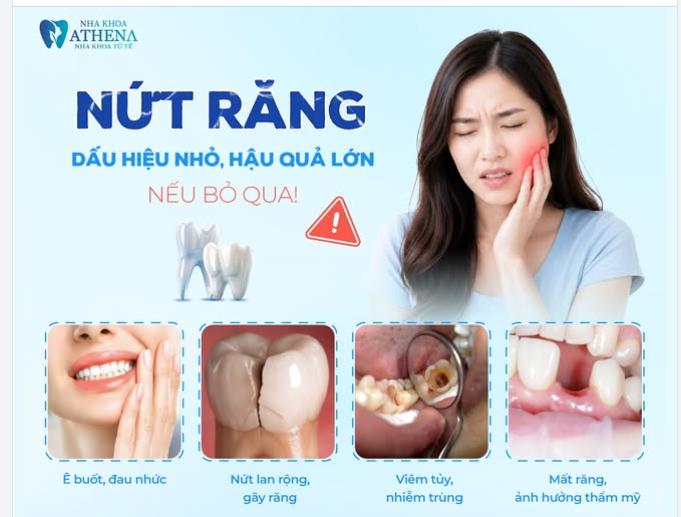 NỨT RĂNG - DẤU HIỆU NHỎ NHƯNG BỎ QUA LÀ HẬU QUẢ LỚN!