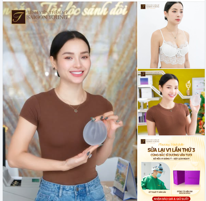 Thành qua 1 tháng sau khi PHƯƠNG TRINH JOLIE SỬA VÒNG 1 LẦN THỨ 3 Phương Trinh đã chọn ERGONOMIX2 tại BVTM SAIGON YOUNG
