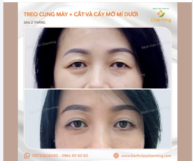 TUỔI TÁC BẮT ĐẦU TỪ ĐÔI MẮT