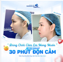 "ĐÚNG CHIẾC CẰM EM MONG ƯỚC BAO LÂU RỒI!"