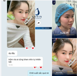 “Trộm vía ai cũng khen nhìn tự nhiên hết”