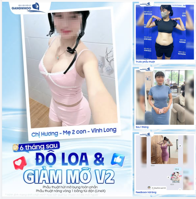 6 THÁNG SAU ĐỘ LOA & CHĂM SÓC VÓC DÁNG V2