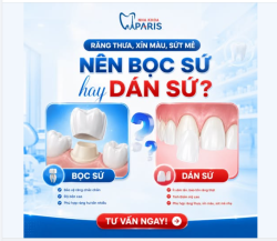 RĂNG THƯA, XỈN MÀU, SỨT MẺ NÊN DÁN SỨ VENEER HAY BỌC RĂNG SỨ?