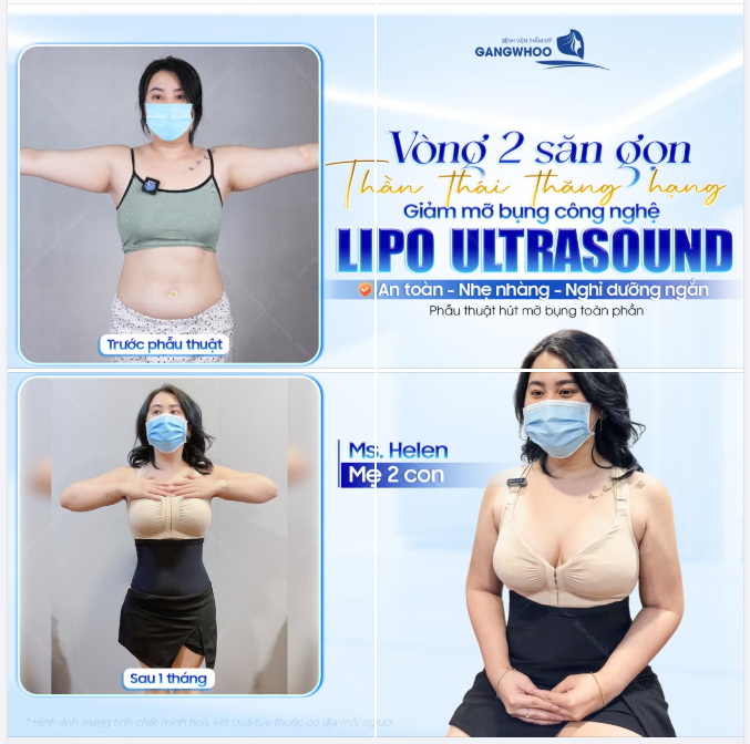 VÒNG EO SĂN GỌN – THẦN THÁI THĂNG HẠNG